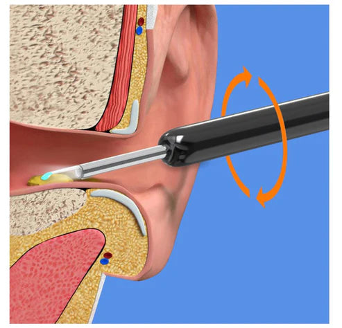 Waterproof Ear Wax Removal Cleaner Kit